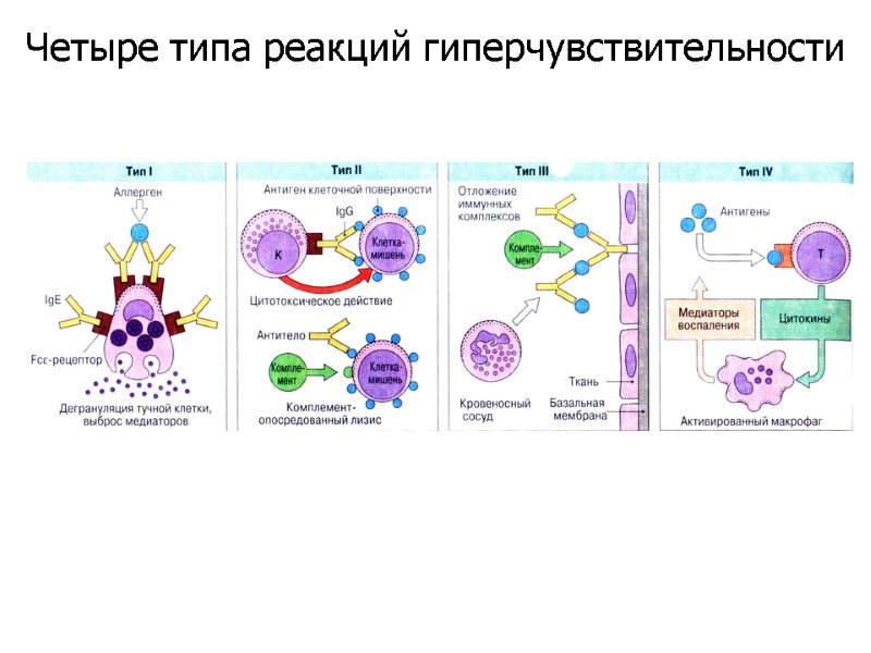 Четыре типа реакций гиперчувствительности